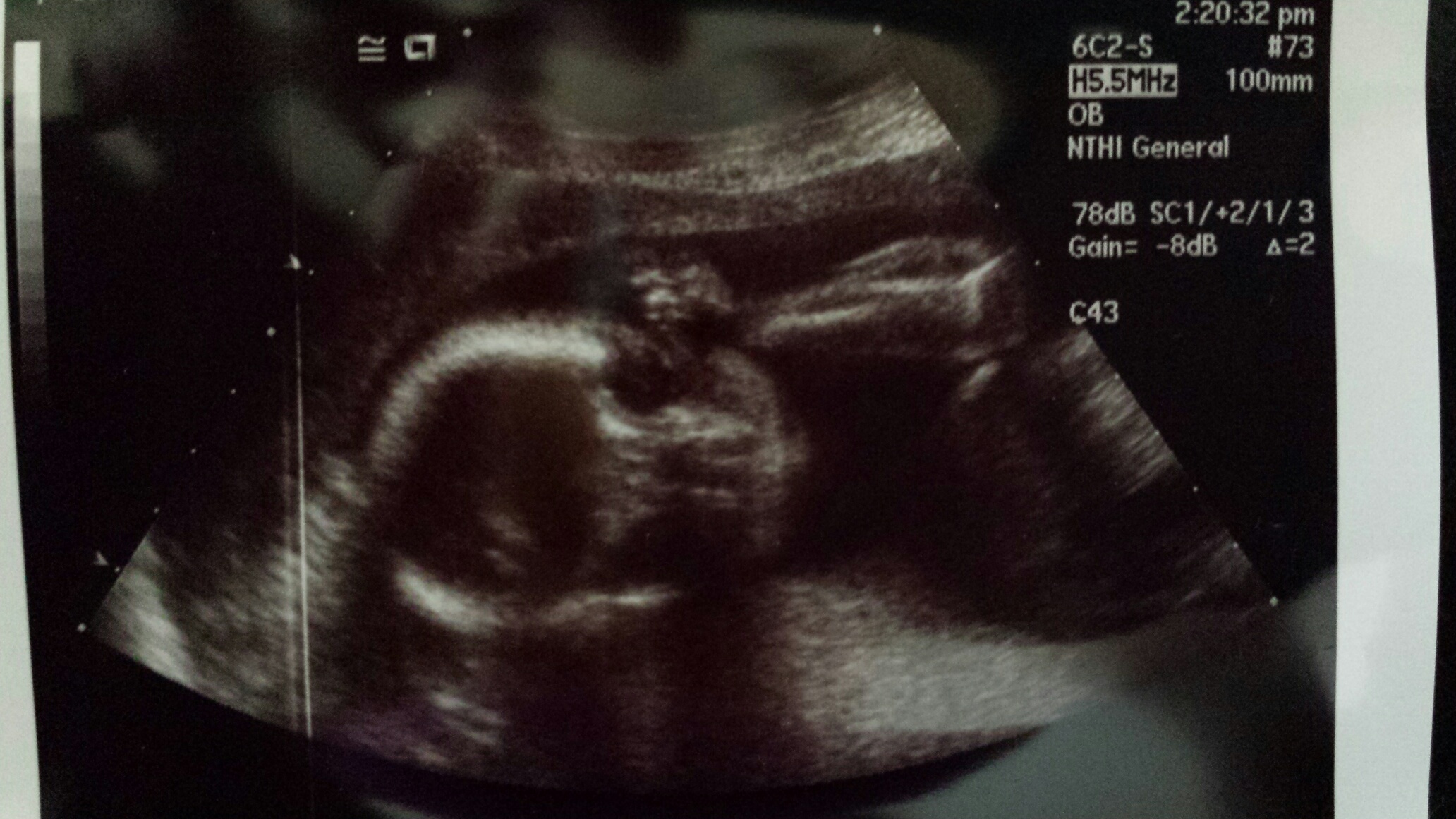 Name:  BABY.jpeg
Views: 138
Size:  606.5 KB