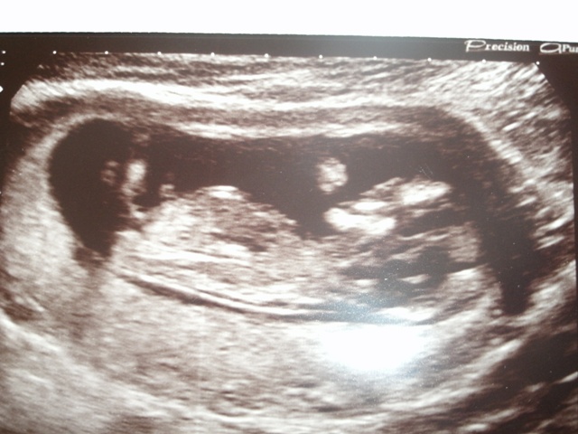 Name:  baby1.jpg
Views: 118
Size:  141.1 KB