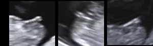 Name:  Fork.jpg
Views: 182
Size:  37.4 KB