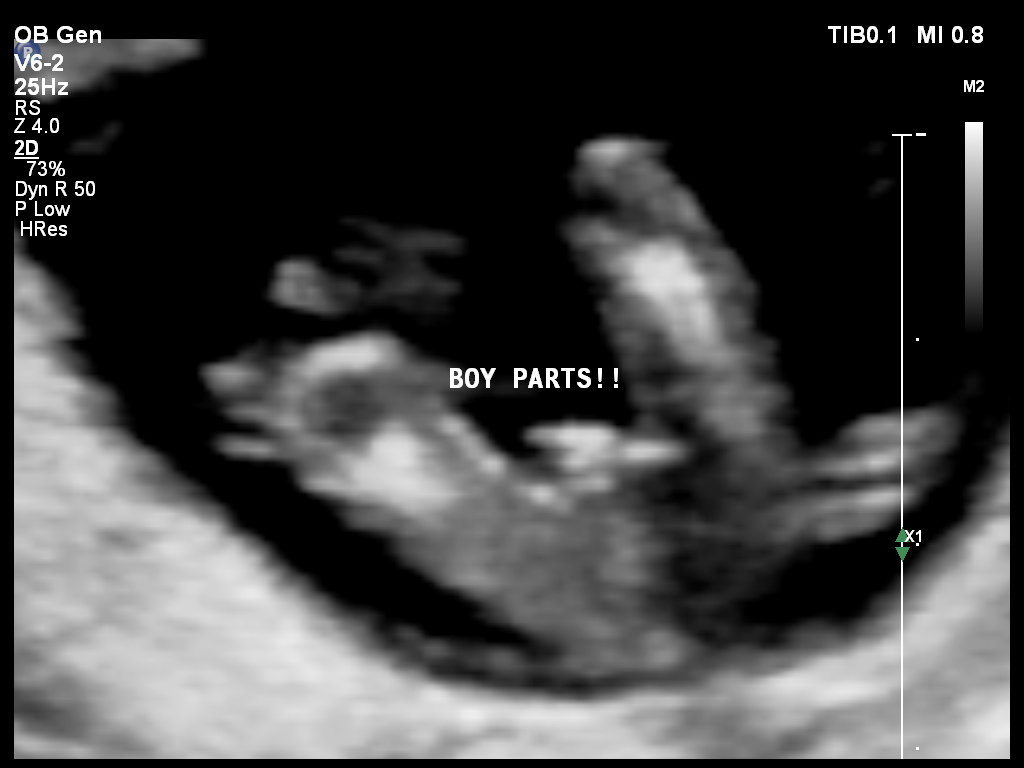 Name:  PATIENT 3120140828150757822.jpg
Views: 81
Size:  102.5 KB