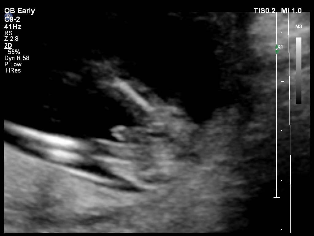 Name:  PATIENT 3120140828151810329.jpg
Views: 715
Size:  114.6 KB