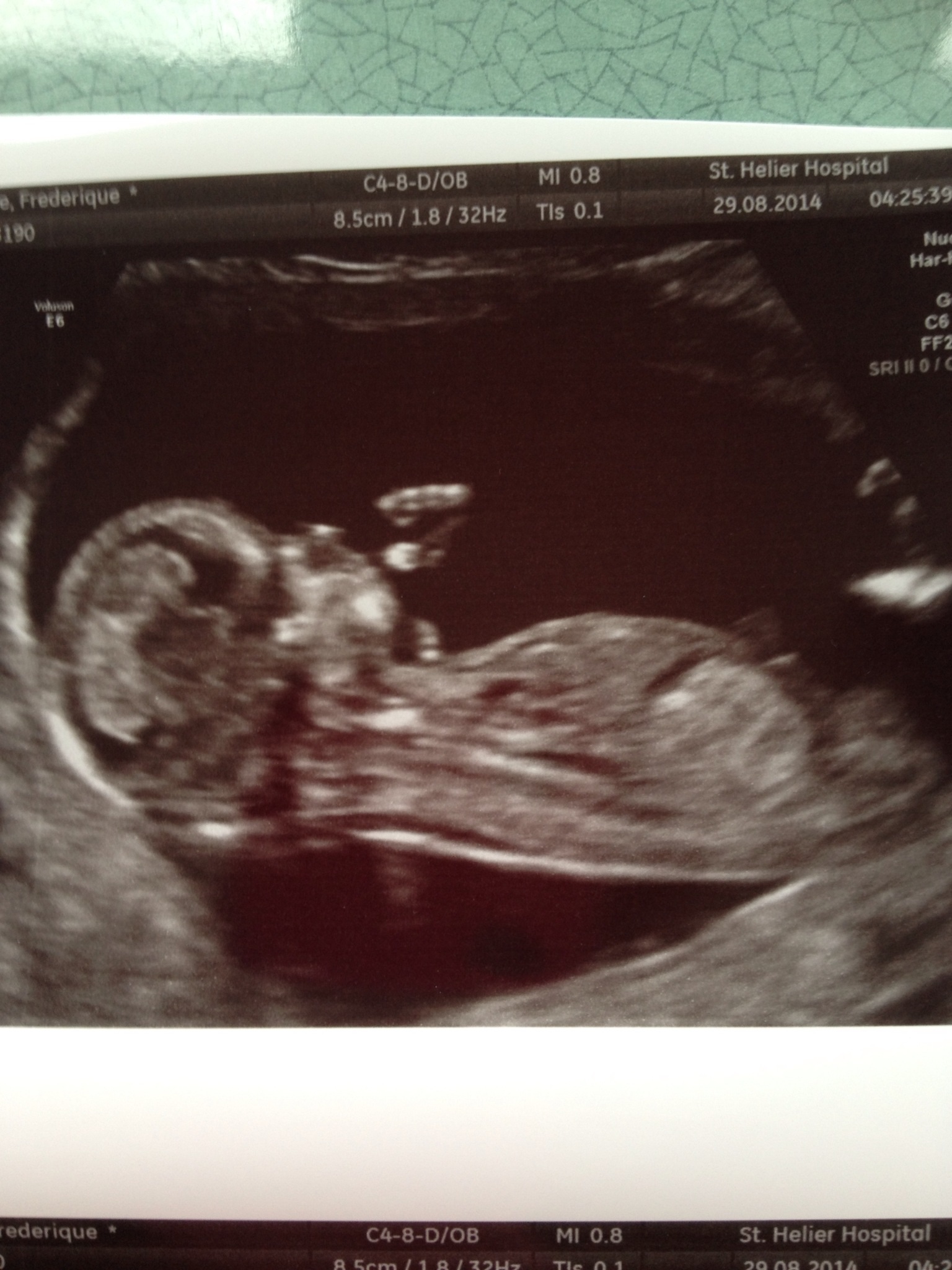 Name:  image.jpg
Views: 116
Size:  570.1 KB