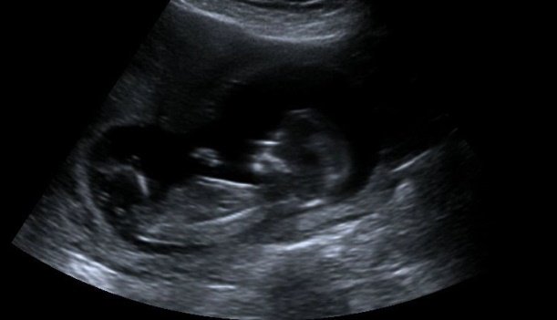 Name:  baby nub.jpg
Views: 127
Size:  36.6 KB