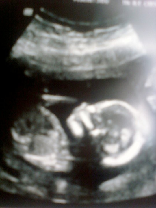 Name:  image.jpg
Views: 159
Size:  65.5 KB