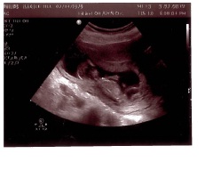Name:  baby 1.jpg
Views: 4276
Size:  13.7 KB