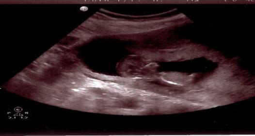 Name:  baby 2.jpg
Views: 4188
Size:  15.5 KB