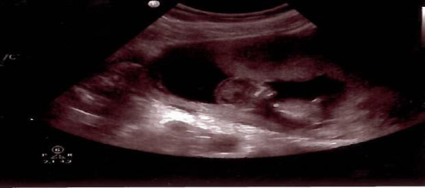 Name:  baby 3.jpg
Views: 4306
Size:  15.9 KB