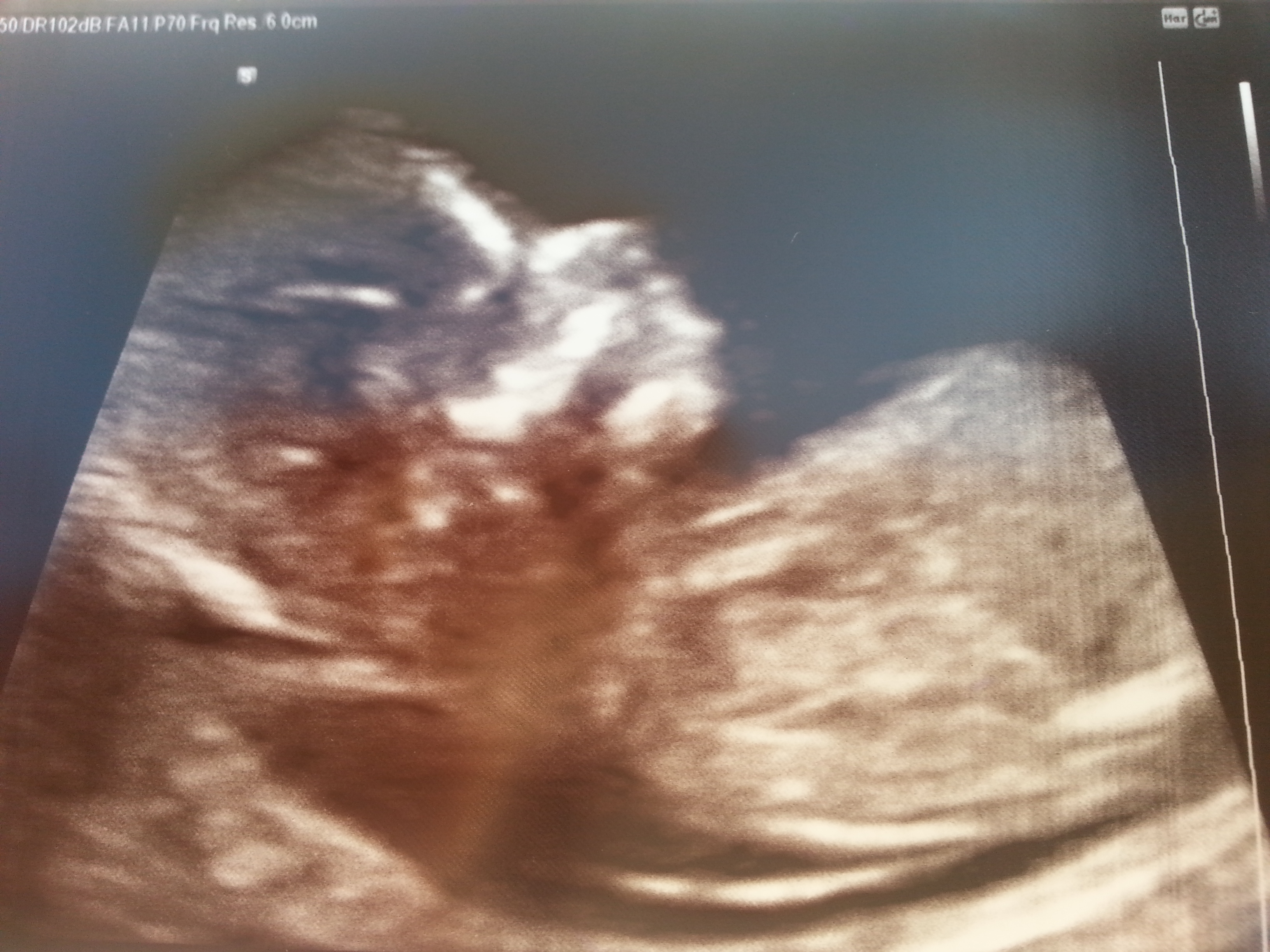 Name:  baby pic.jpg
Views: 140
Size:  2.03 MB