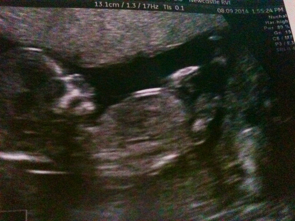 Name:  14weeks.JPG
Views: 201
Size:  292.0 KB