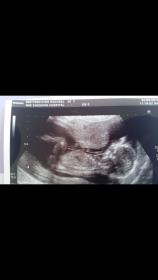 Name:  Screenshot_2014-09-05-13-19-19.jpg
Views: 198
Size:  4.6 KB