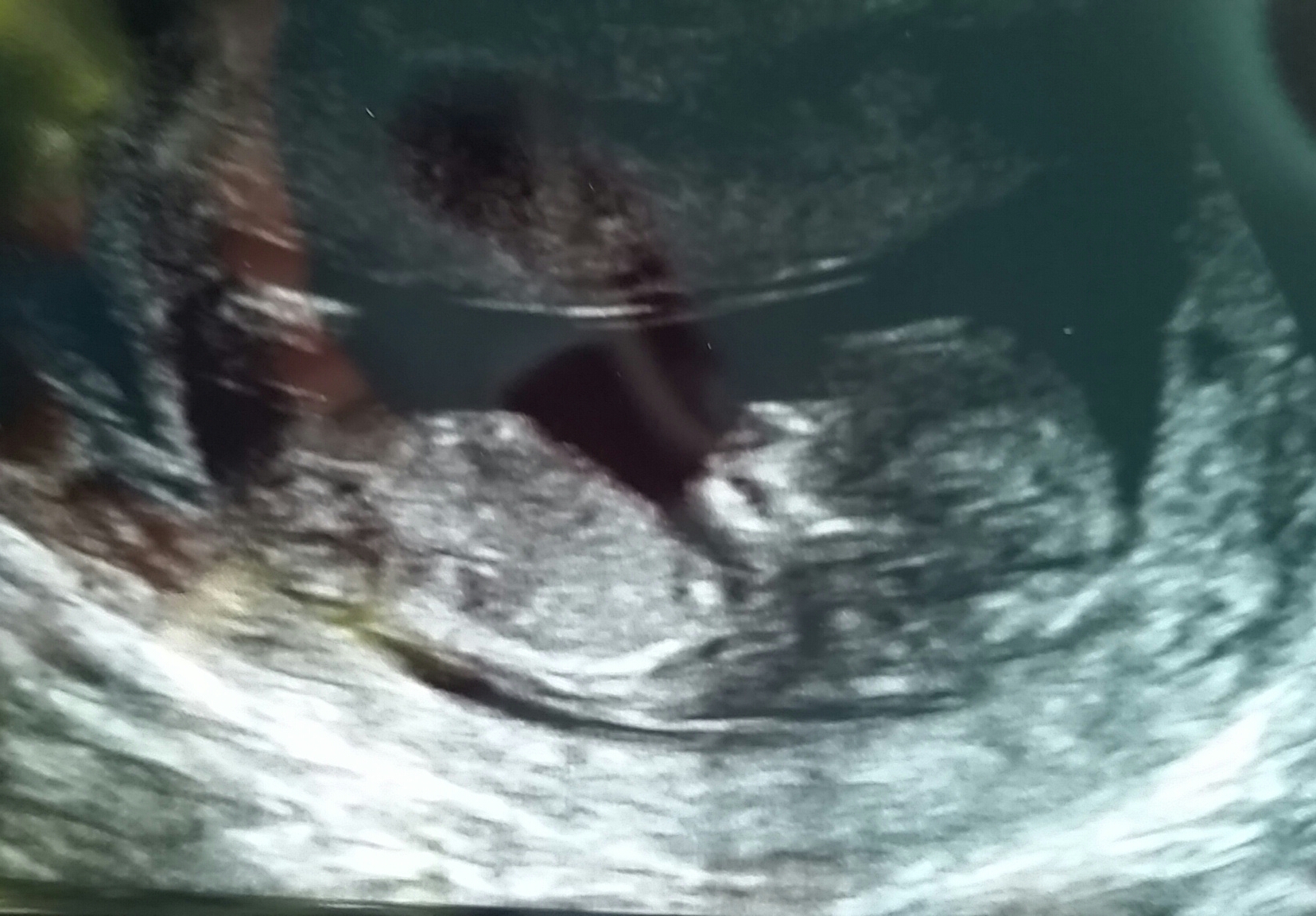 Name:  baby.jpg
Views: 182
Size:  992.0 KB