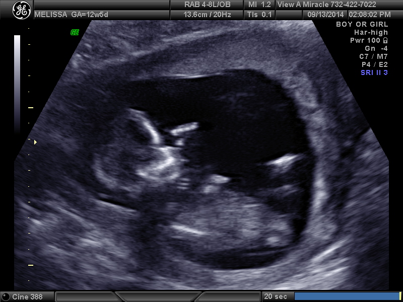 Name:  BABY GIRL_9.JPG
Views: 671
Size:  179.4 KB