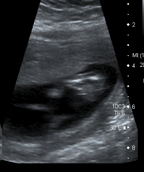 Name:  OB 00018.jpg
Views: 145
Size:  62.2 KB