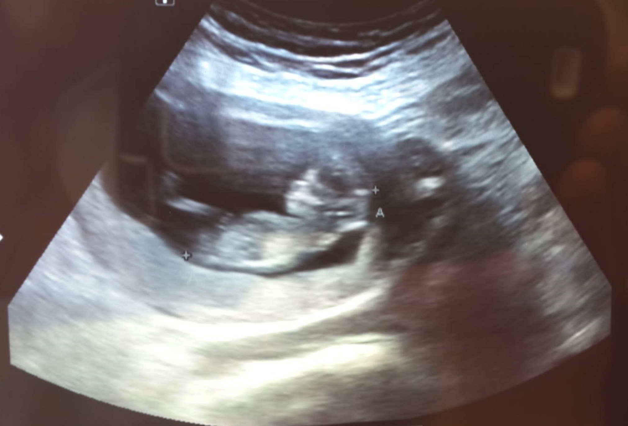 Name:  baby2.jpg
Views: 132
Size:  305.5 KB