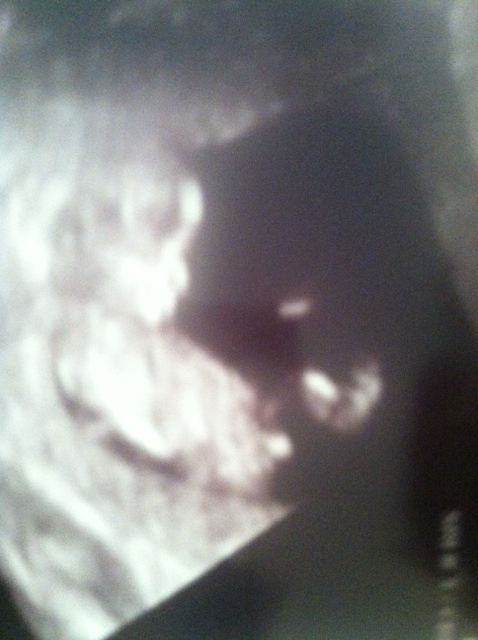Name:  baby3.jpg
Views: 145
Size:  101.0 KB