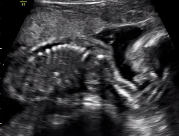 Name:  Baby copy.jpg
Views: 476
Size:  68.5 KB