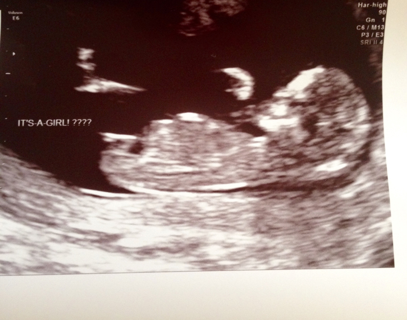 Name:  baby3.jpg
Views: 1079
Size:  311.8 KB