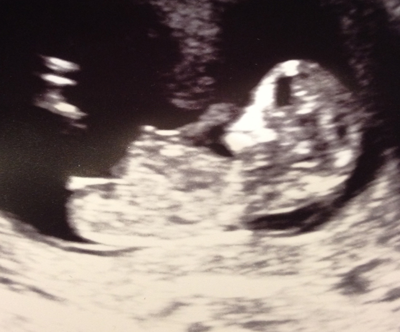 Name:  baby1.jpg
Views: 633
Size:  294.8 KB