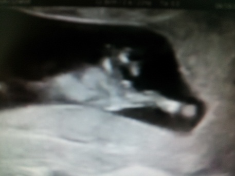 Name:  Baby2.jpg
Views: 310
Size:  31.2 KB