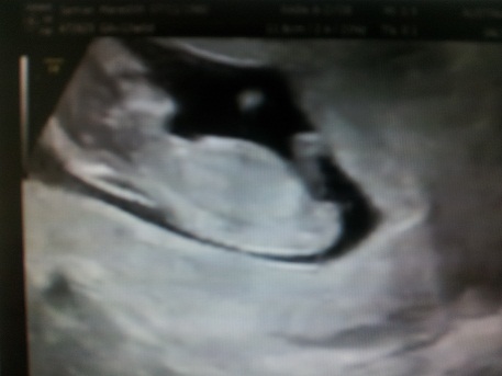 Name:  Baby4.jpg
Views: 284
Size:  33.7 KB