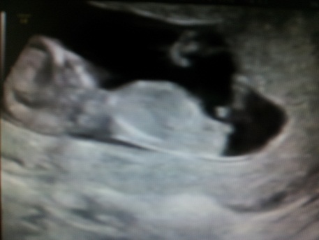 Name:  Baby5.jpg
Views: 240
Size:  33.7 KB