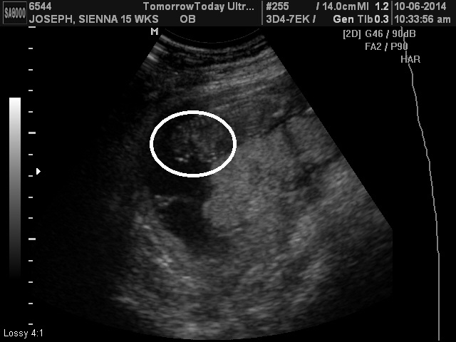 Name:  babybabyfeet.jpg
Views: 446
Size:  71.5 KB