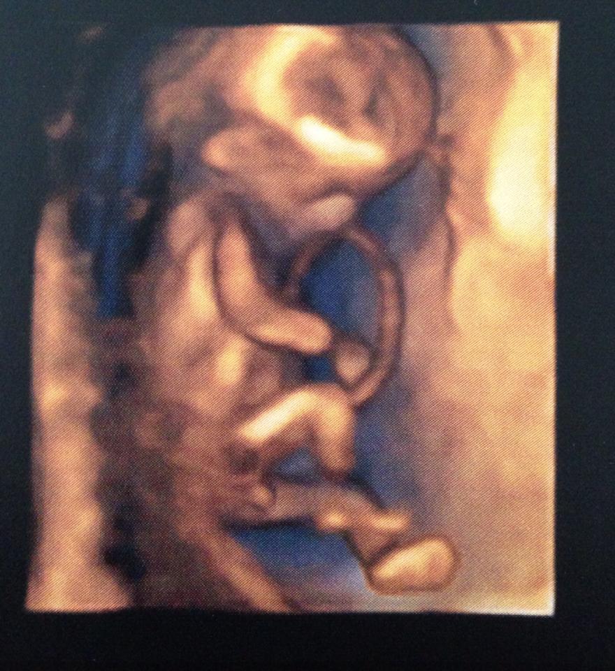 Name:  Baby.jpg
Views: 151
Size:  149.4 KB