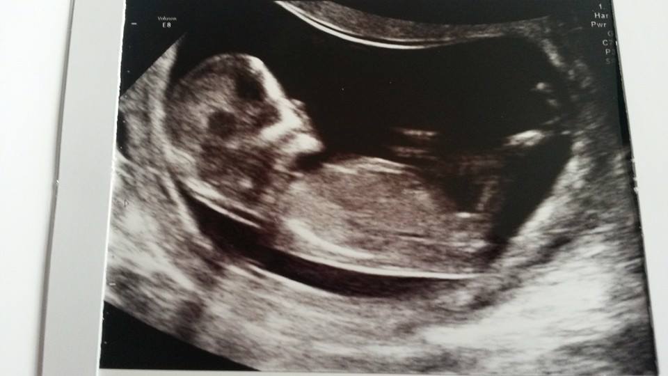 Name:  baby 5.jpg
Views: 237
Size:  47.2 KB