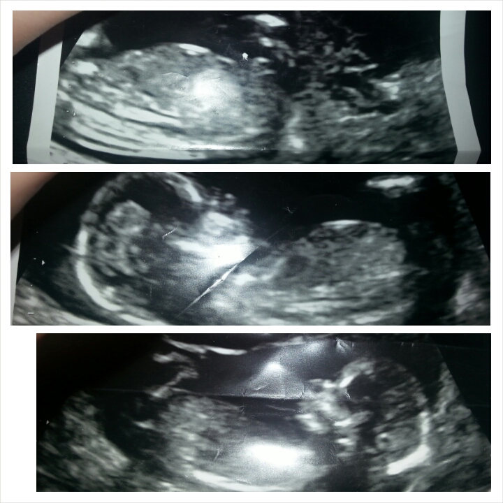 Name:  PhotoGrid_1413213472075.jpg
Views: 178
Size:  320.8 KB