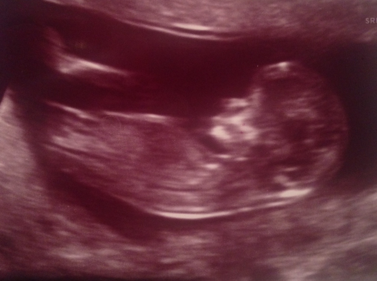 Name:  baby2.jpg
Views: 160
Size:  275.5 KB