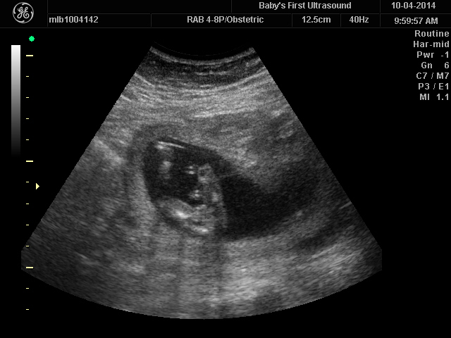 Name:  BABAAY_6.JPG
Views: 348
Size:  105.6 KB