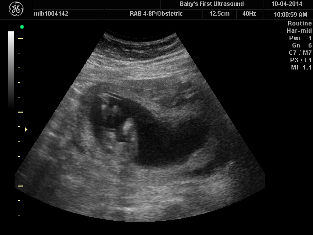Name:  BABAAY_9.JPG
Views: 169
Size:  100.6 KB