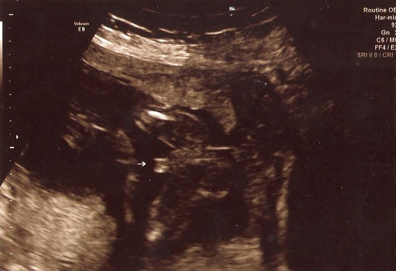 Name:  Baby3.jpg
Views: 127
Size:  87.3 KB