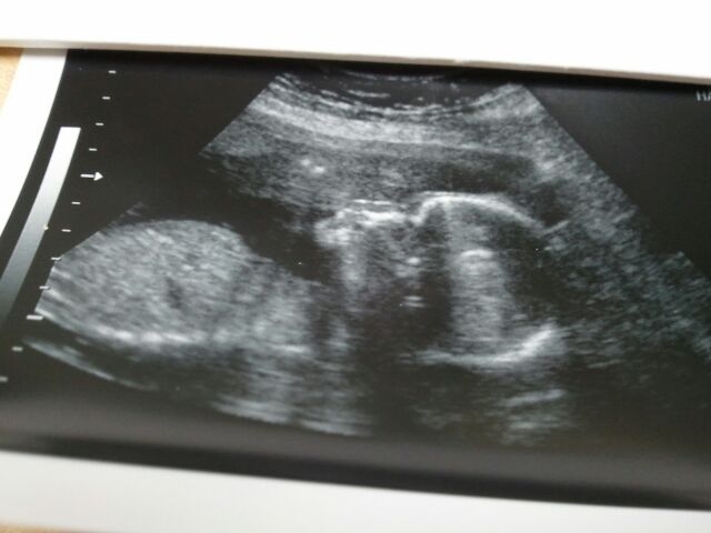 Name:  profilebaby3.JPG
Views: 714
Size:  94.3 KB