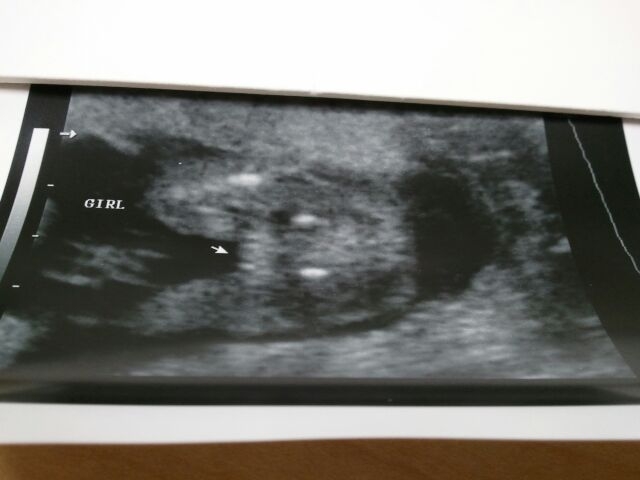 Name:  baby3potty.JPG
Views: 746
Size:  82.3 KB