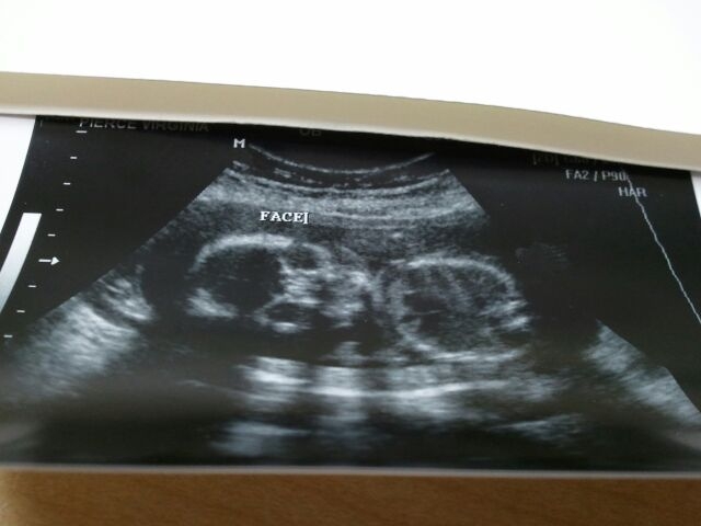 Name:  baby3face.JPG
Views: 742
Size:  92.6 KB