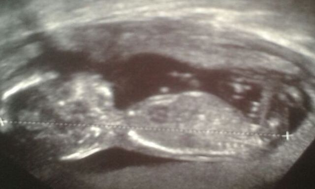 Name:  Baby.jpg
Views: 99
Size:  29.2 KB