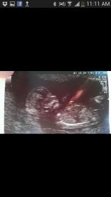 Name:  Screenshot_2014-11-02-11-11-53.jpg
Views: 171
Size:  5.1 KB
