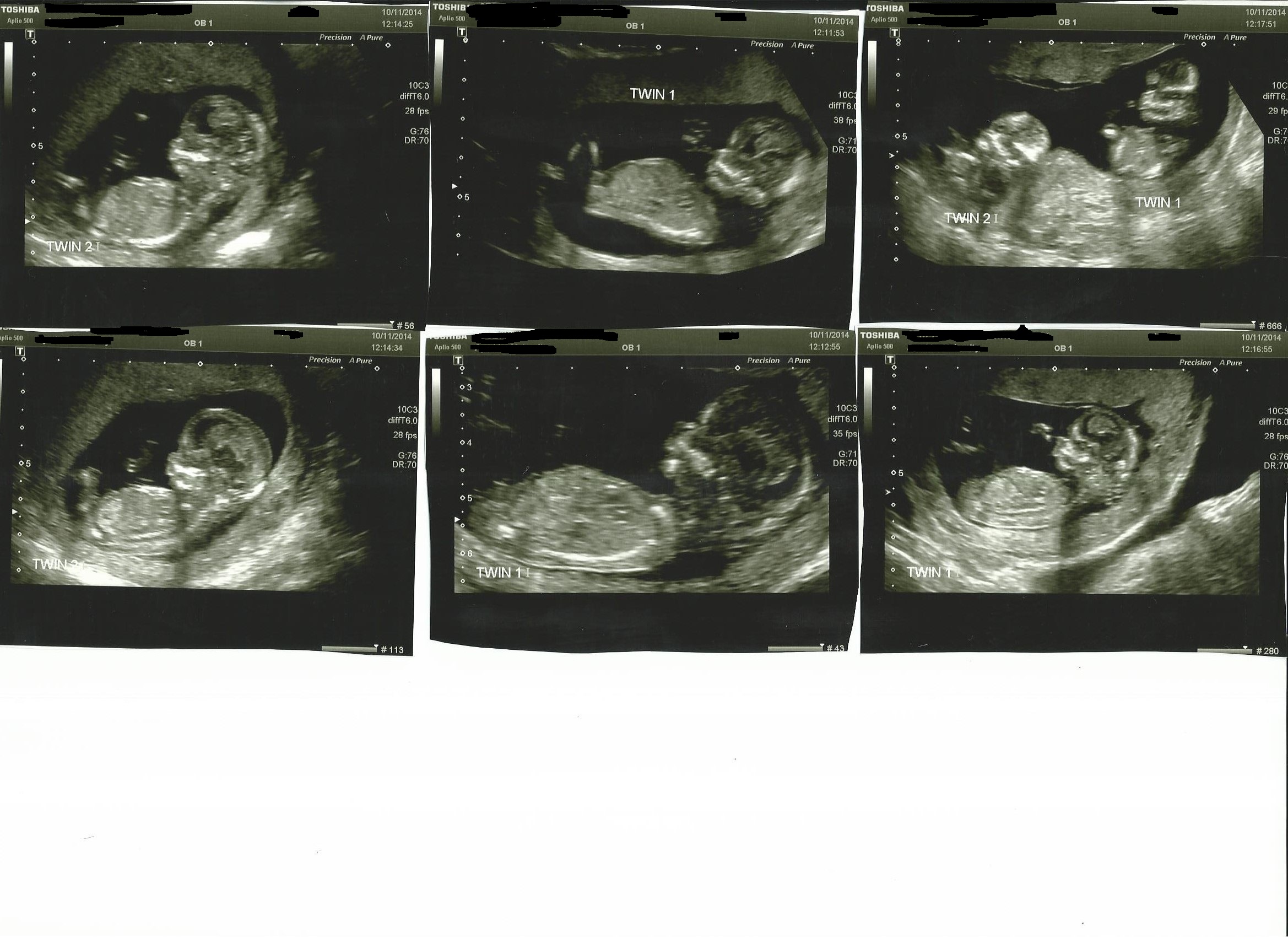 Name:  baby scan new Nov 10.jpg
Views: 581
Size:  637.5 KB