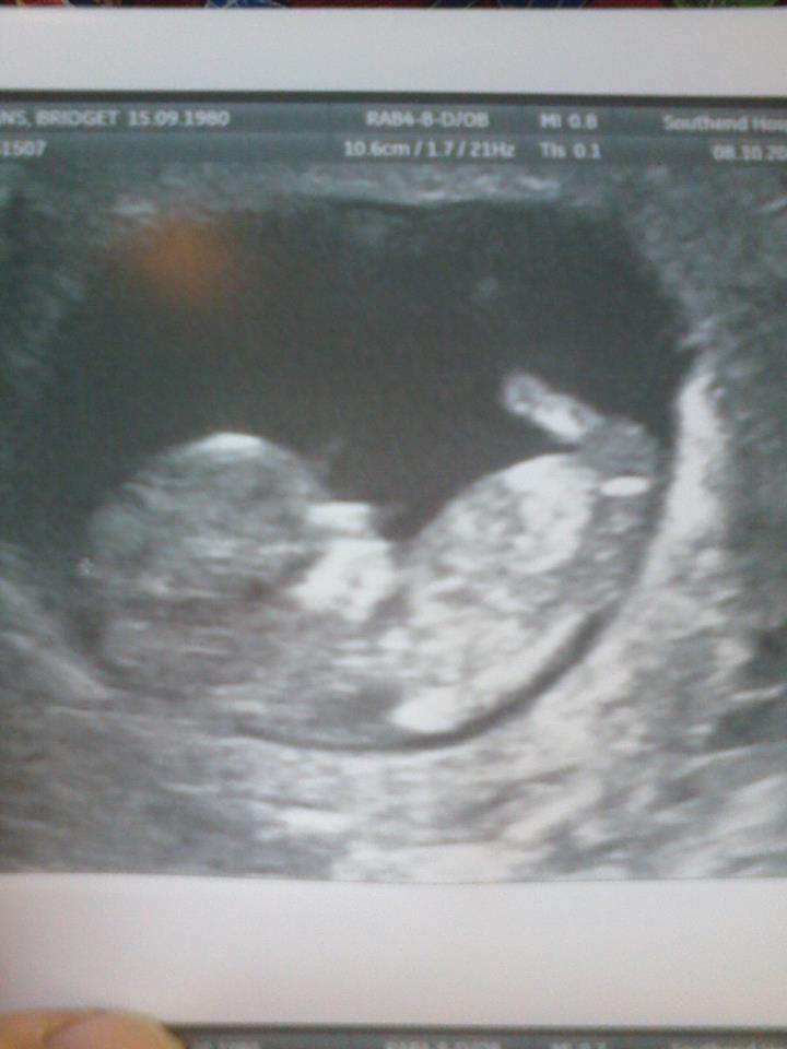 Name:  baby#5.jpg
Views: 232
Size:  47.7 KB