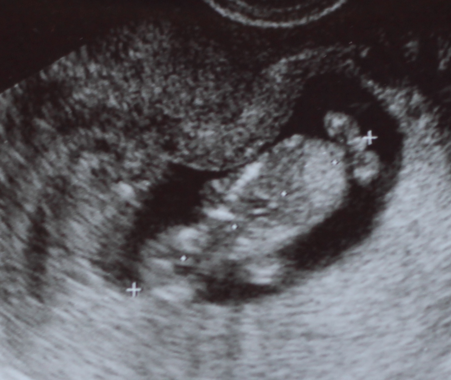 Name:  Ultrasound photos 006 (2).jpg
Views: 250
Size:  571.7 KB