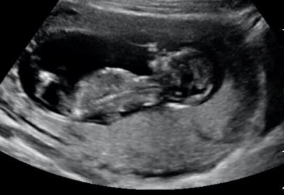 Name:  baby shot.jpg
Views: 277
Size:  15.7 KB