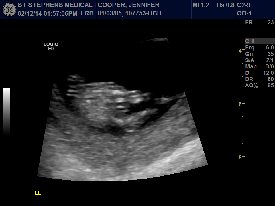 Name:  Image22.jpg
Views: 199
Size:  221.0 KB