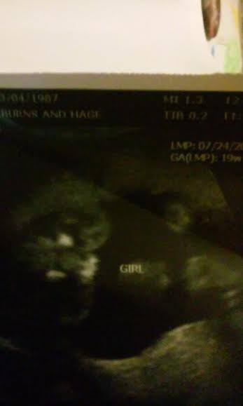Name:  baby girl.jpg
Views: 72
Size:  9.4 KB