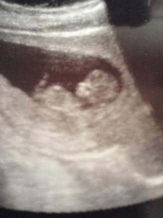 Name:  baby 2.jpg
Views: 393
Size:  9.1 KB