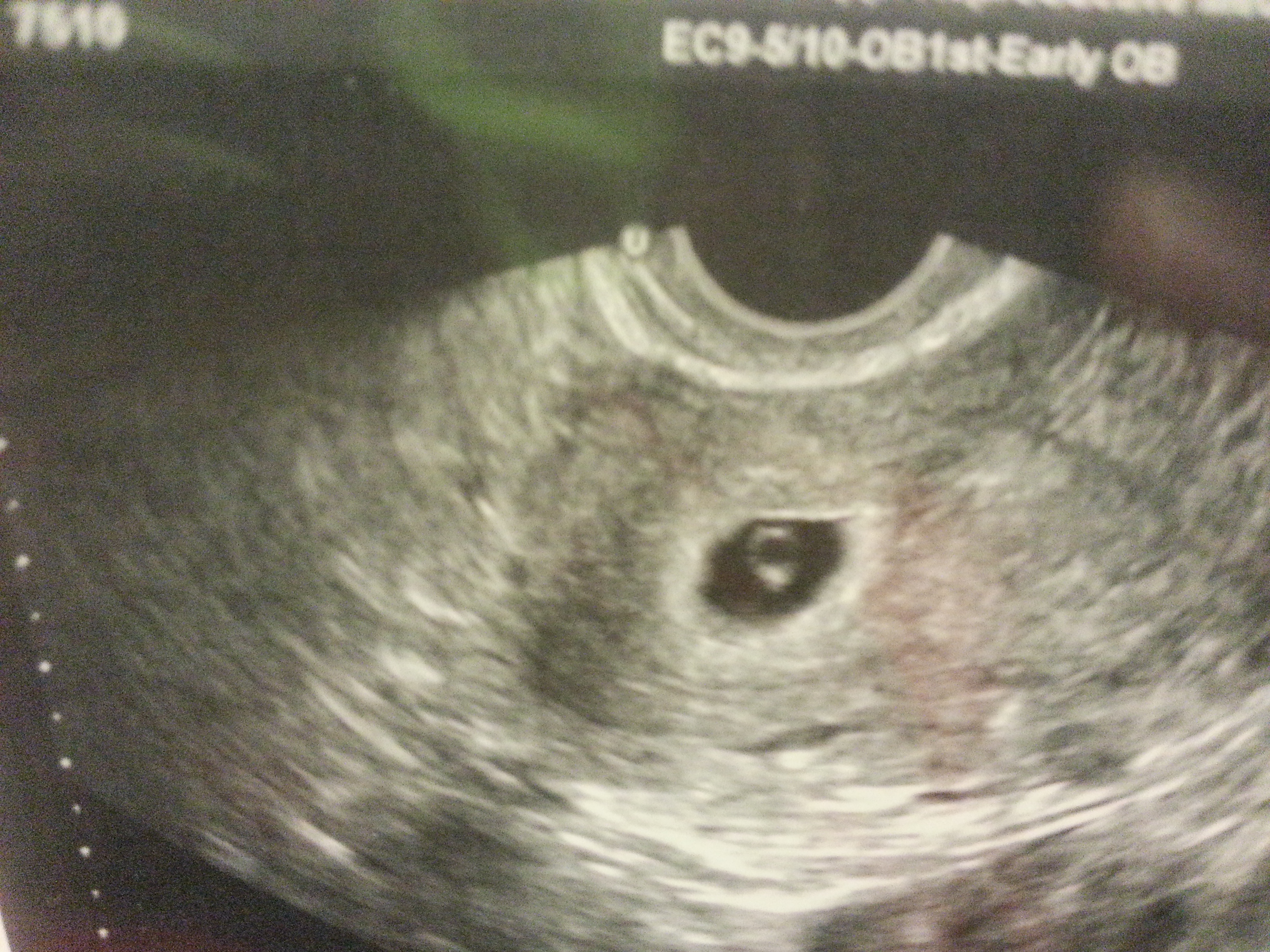 Name:  mason 5 wks 5 days.jpg
Views: 295
Size:  3.51 MB