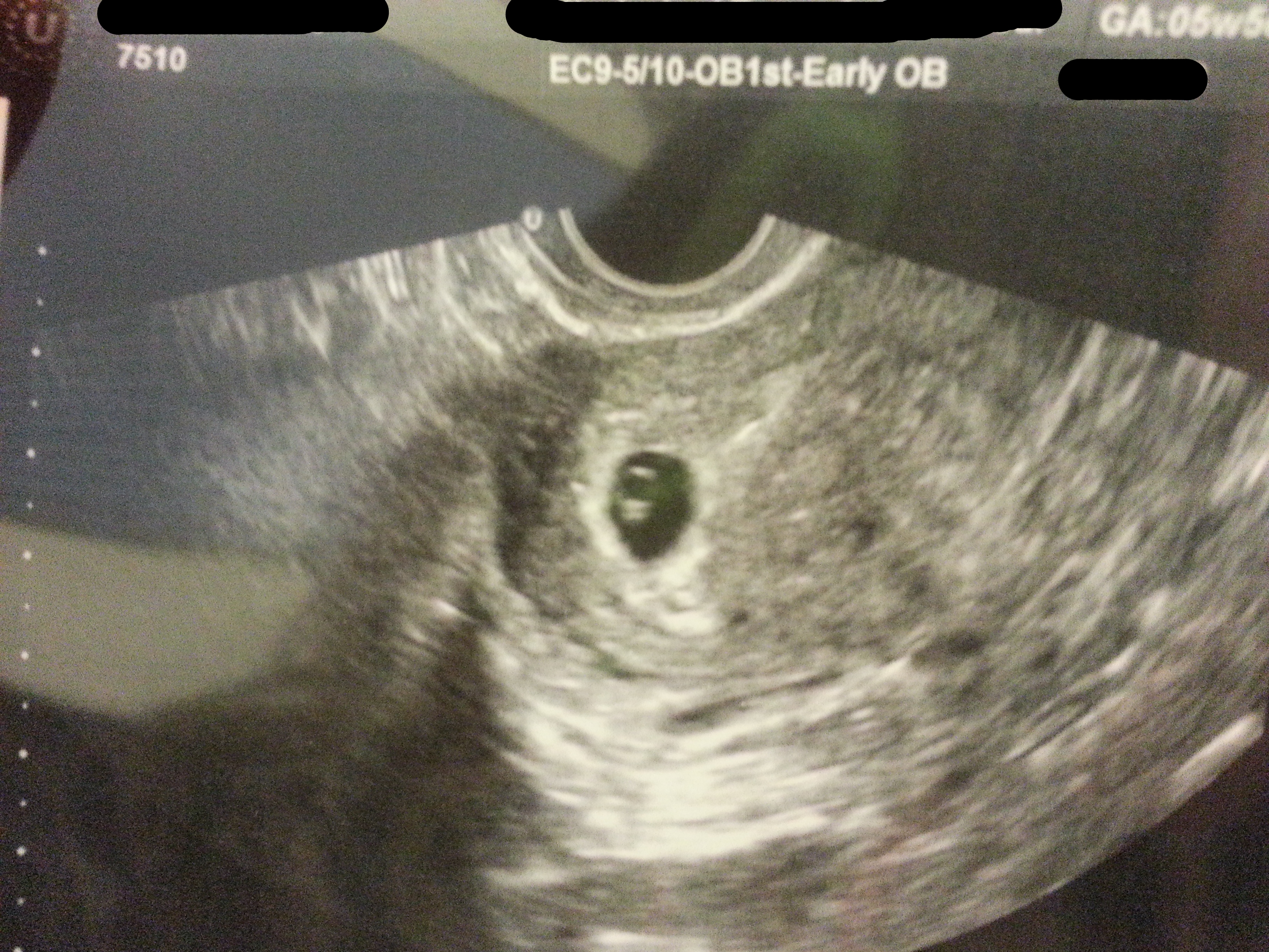 Name:  mason 5 wks 5 days 2.jpg
Views: 341
Size:  5.27 MB