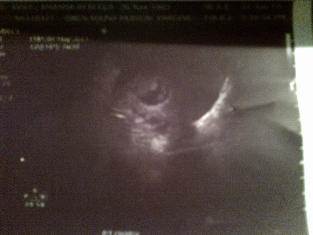 Name:  ultra sound dec 12.jpg
Views: 196
Size:  172.6 KB