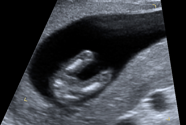 Name:  pottyshot12w1d-1.jpg
Views: 519
Size:  171.0 KB