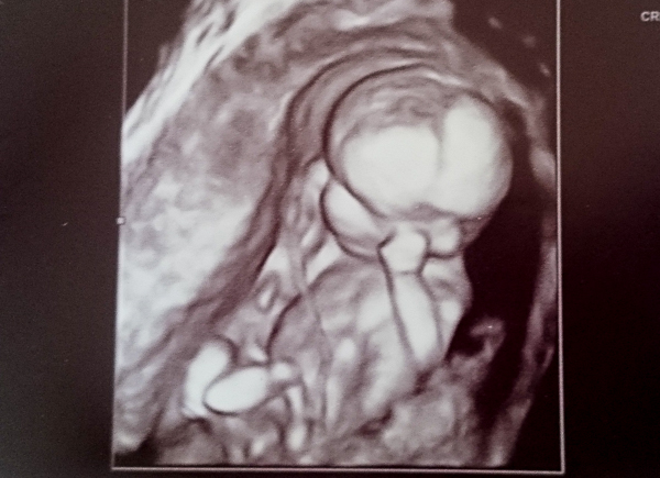 Name:  3d 14weeks-1.jpg
Views: 655
Size:  182.3 KB